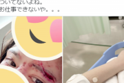 【悲報】人気セクシー女優さん、大事故を起こして大けがを負ってしまう…