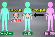 子宮のない女性に健康な女性の子宮を移植する「子宮移植」ついに始まる