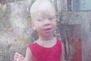 【長井市ホームタウン問題】タンザニア、アルビノの2歳の女児殺害で父親と神父ら9人逮捕　女児の遺体の一部が欠損