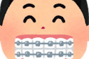 歯列矯正しない奴(させない親)て何が目的なんや？ｗｗｗｗｗｗｗｗｗｗｗｗｗｗｗｗ