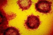 【コロナの型が違う？】NYの凶悪コロナ、欧州由来と判明！日本のはどっち？