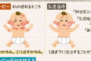 乳児湿疹どのくらいでよくなりましたか？