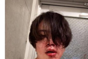 【事件】有名YouTuber、新宿でボコボコに殴られ血まみれになりXで報告