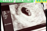 【闇深】「すんげぇの売られてた」 女性が妊娠時に撮影する“胎児のエコー写真”がフリマサイトに出品…一体、誰がなんのために使うのか？