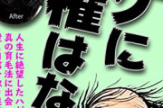 【悲報】ハゲるヤツの「生活習慣」がこちら。もう手遅れか？ｗｗｗｗ