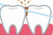 歯医者「フロスは毎日やれっていったよね??」←これ