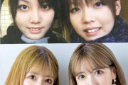 【画像】美人双子モデル「二人で整形しました」パシャ