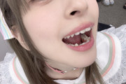 【画像】声優・月音こなちゃんの歯ｗｗｗｗｗ【ラブライブ！蓮ノ空】