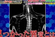 【悲報】柏木由紀が難病「脊髄腫瘍」との診断・・・アイドルは続ける模様！！【ゆきりん】