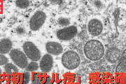 【終国】サル痘、日本上陸。