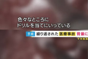 【悲報】脳外科医 竹田くんの手術映像をみた外科医の感想「色々なところにドリルを当てにいってる」