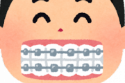 歯列矯正のメリットって何？