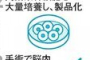 【再生医療】傷ついた脳、幹細胞で再生　バイオベンチャー治験で確認