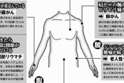 「左だけ肩こり」は心筋梗塞が原因？上半身の病気のサイン・・・