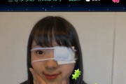 【悲報】NMB三宅ゆりあちゃん、左目負傷し眼帯で配信