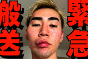 【悲報】高学歴YouTuberさん、有名YouTuberに暴行を受け緊急搬送される