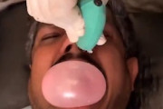 【動画】何の治療？鼻から入れた風船を口の中で割る治療。