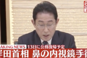 【速報】岸田首相、あす全身麻酔手術へ