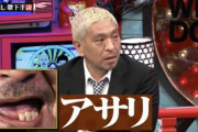 【悲報】 歯がボロボロワイ、おせんべいもアーモンドもピザの耳も食べることができない