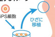 【再生医療】ｉＰＳ細胞から「大量に作れる軟骨」　移植して修復期待