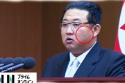 【悲報】金正恩　左頬にニキビができただけでニュースになるｗｗｗｗｗｗｗｗｗｗｗｗ