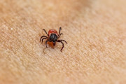 【アメリカ】マダニ原因に噛まれて牛・豚肉のアレルギーになるα-gal（アルファ・ガル）症候群が拡大中