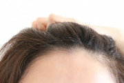 【薄毛】最近頭頂部が薄いZ世代の女性増えてない？