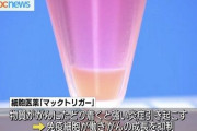 【朗報】九州大学、抗がん剤を使わない新たながん治療方法を世界で初めて開発！これは世紀の大発明か…！？