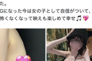【画像】女の子「豊胸手術して人生が変わった。マジでおすすめ」
