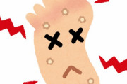 足の裏に出来たウイルス性のイボの治療したから歩く度に激痛が走る