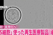 【速報】『iPS細胞』を使った医薬品、ガチで実用化される