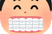 28歳やが歯列矯正しようか悩んでるｗｗｗｗｗｗｗｗ