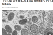 【緊急】「サル痘」患者200人以上確認 欧米各国 　松野官房長官「現時点で国内未確認 発生動向を監視」