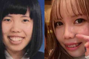 【整形美女】顎変形症の女性が整形で得たものとは？ 「努力して可愛くなったんだね」自尊心を保てた彼氏からの言葉