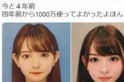 小悪魔agehaのモデル、1000万かけて整形して激変してしまうｗ
