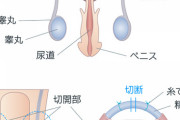 ２３歳でパイプカットする男だけど質問ある？