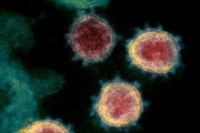 コロナウイルス、感染経験者は回復後も深刻な知能低下　統合失調症を発症させる可能性も