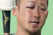 【画像】中田翔、やっぱり多分殴られていた