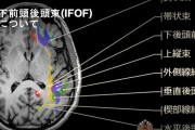 火病だよね　〜　【韓国調査】長時間勤務で脳の構造が変化、認知や感情制御に影響も