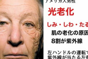 【警告】皮膚科医「日焼け止めしない人、”こう”なる」