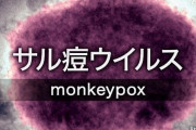 【悲報】超大国アメリカ、「サル痘」感染者が爆増　えげつない感染者数に