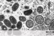 【悲報】サル痘の感染者、98.8%が男性　感染者の多くは男性との性的接触のある男性