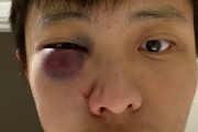 【シンガポール人？】イギリスのイケメン中国人、「コロナウイルス出ていけ」と顔の形が変わるまでブン殴られる