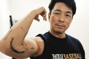トミージョン手術さん、野球界に革命をもたらす