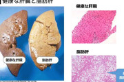 彡（◯）（◯）「これ健康な人の肝臓ってあるけどこの写真のためだけに殺されたんか？」
