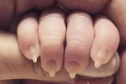 【画像】新生児に長く尖った爪でSNS大炎上ｗｗｗｗｗ