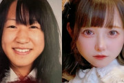 【姉妹間の顔面格差】小5で整形した女性「なんで妹は可愛いのに私だけ…」「“整形＝悪”の風潮を壊したい」←これ?