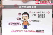 【注意！】子供の手足に急な「まひ」相次ぐ【エンテロウイルス】