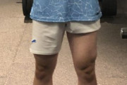【衝撃画像】ワイの脚、”怨念”が宿ってしまう・・・