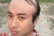 ムロツヨシさん、ハゲる